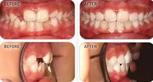 Case study