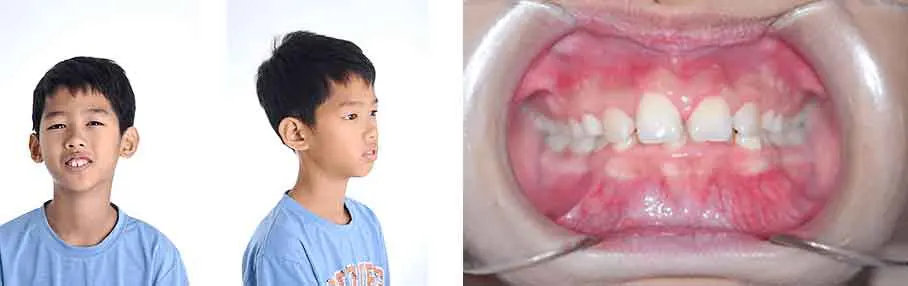 รีวิวน้องนีโอ
