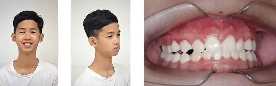 รีวิวน้องนีโอ