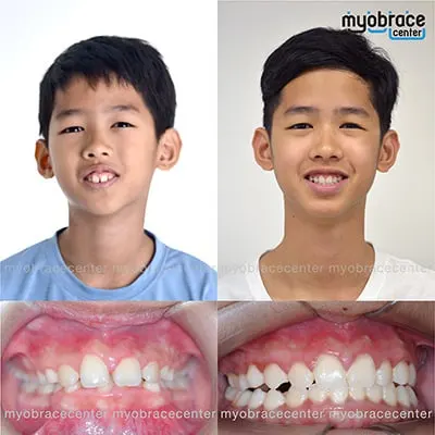 รีวิวน้องนีโอ